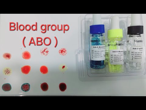 طريقة عمل فصيلة الدم Blood Group.   (ABO) طريقة السلايد  Slid method #فصائل_الدم  #مختبرات_طبيه